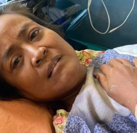 कलाकार पल्पसा डंगोल ‘चम्सुरी’को सफलतापूर्वक मिर्गौला प्रत्यारोपण