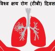 आज विश्व क्षयरोग दिवस मनाइँदै