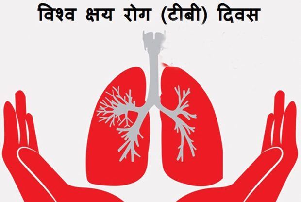 आज विश्व क्षयरोग दिवस मनाइँदै